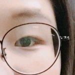 내 쌍수 <b>전후</b>