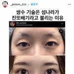 일본이 진짜 <b>쌍수</b>하나는 잘뽑나보다