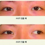 나 <b>외사시</b>있음 시 바..