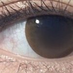 [댓글부탁해] <b>이런</b> <b>렌즈</b> ㅊㅊ좀 ㅠㅠㅠ