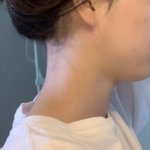 [댓글부탁해] 뮤잉운동 <b>비포</b> 애프터 보여줄까?