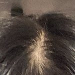 야 ㅁㅊ 나 <b>탈모</b>냐?