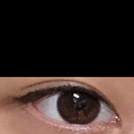 [추반] 나 쌍수 재수술할까