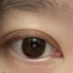 [댓글부탁해] <b>쌍수</b> 했는데 이런경우도 있음?