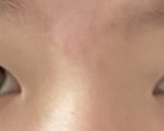 너넨 <b>내</b><b>눈</b>이면 쌍수할꺼임??호불호 ㅈㄴ갈림