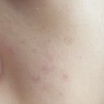 나 <b>쿠션</b>만 바르면 이렇게 되는데 어떡해ㅜㅜ