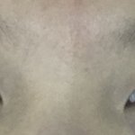 <b>쌍수</b> 해야것지