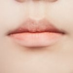 <b>증사</b> 나왔는데 입술 어떡하지