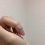 <b>화상</b>입었는데 어카냐