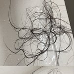 [댓글부탁해] 얘들아 나 진지하게 탈모야? 혐주의