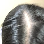 [댓글부탁해] 얘들아 나 <b>탈모</b>같아??