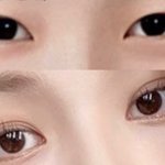 [댓글부탁해] 성형 뭐뭐한지 알려줄 <b>판녀</b>
