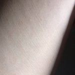 [19] 나 허벅지에 이거 튼살임?