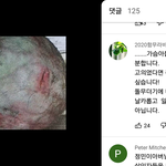 손정민 뒷머리상처 뼈가보일정도깊은상처