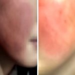 여고생 ‘학폭’ 신고하자 <b>보복</b>폭행에 학부모 협박까지