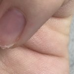 <b>손톱</b> 부러졌는데 이거 어떡함