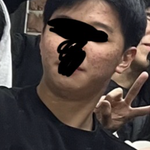 [<b>댓글</b>부탁해] 형 누나들 <b>저</b> 피부 거부감 드나요