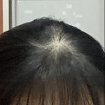 [댓글부탁해] 얘들아 앞머리 <b>탈모</b> 어떡게?ㅠㅠ