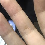 [ㅈㄱㄴ] 얘들아 내 손 <b>껍질</b> 벗겨진다