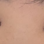 [댓글부탁해] 쌍수 6일차 어때요