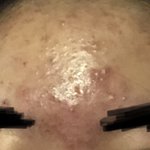 [꼭조언부탁] 청소년기 여드름 피부 고치는 법 좀 알<b>려조</b>ㅠㅠㅠ