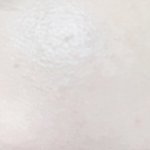 와 나 피부 ㅈㄴ 좋아짐 미친