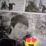 여신강림 <b>황인엽</b> 성형수술