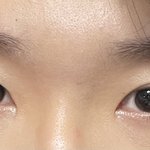 나 쌍수 할지말지 골라주면 부모님 만수무강