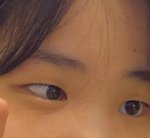 [댓글부탁해] 수능 끝나고 쌍수할 친구들을 위한 후기