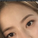 쌍수 하려는데 도와줘ㅠㅠ