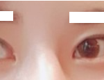 [방탈죄송] <b>이</b> 정도면 <b>눈</b> 미간 좁은거라고 할수있음?