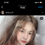 [댓글부탁해] <b>입술</b>필러 맞으면 <b>입술</b> 이<b>정도</b>로 커짐 ??