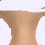 코성형 할까말까