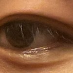 [19] <b>쌍수</b> 나보다 망한 애 있냐 진짜ㅋㅋ…