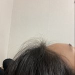 [드루와] <b>이마</b> 튀어나온거 ㄹㅇ 개스트레슨데