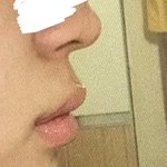 [드루와] 이런 <b>돌출</b>입은 어떻게 교정해?