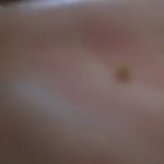 졸라 큰 <b>치석</b> 나왔음 ㅅㅂㅋㅋㅋㅋㅋㅋ