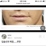 나 <b>이</b> <b>점</b> 빼면 인상 달라질 거 같음??