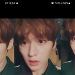 [스키즈] 뭐지?? <b>상처</b> 왜 자리가 같지?