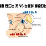 쌍수하고나서 눈물나올<b>때</b>마다 <b>눈</b>이 너무 아파