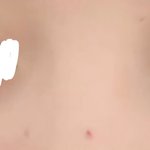 <b>코쉐딩</b> 전후 차이는 내가 제일 심할 듯