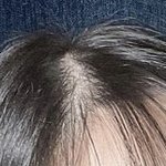 [꼭조언부탁] 여자 이 정도면 <b>탈모</b>인가요