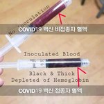 백신 안맞길 잘했다
