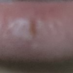 [드루와] 입술뜯고 이로깨물었더니 고름<b>물집</b>잡혔어