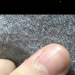 내 <b>엄지</b> 변천사