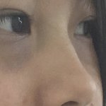 나 코 복코임,??