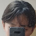 [댓글부탁해] 나 탈모 <b>진행</b>된ㄱㅓ같음???