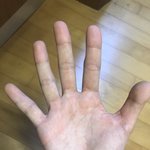 얘들아 <b>내손</b> 단풍손임?