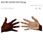 흑인 손바닥이 하얀 이유