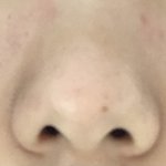 얘들아 내 코 <b>소생</b>불가능이냐..?